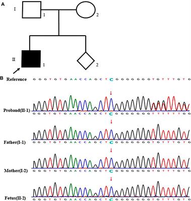 The Evaluation of Genetic Diagnosis on High-Risk Fetal CAKUT